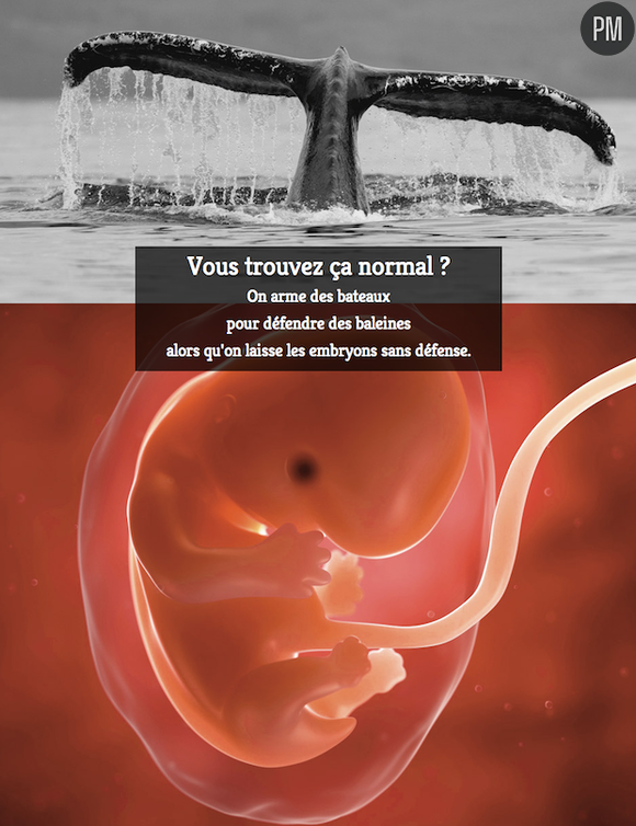 La Fondation Jérôme Lejeune fait une publicité pour défendre l'embryon.