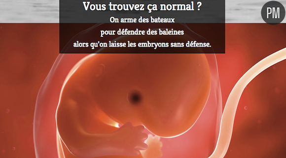 Le Nouvel Obs décrié après la publication de cette publicité anti-avortement.