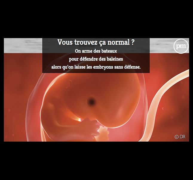 Le Nouvel Obs décrié après la publication de cette publicité anti-avortement.