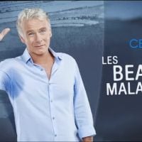 "Les Beaux Malaises" : La série de Franck Dubosc arrive ce soir sur M6